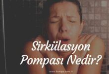 Sirkülasyon pompası nedir